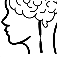 Carotid artery disease 